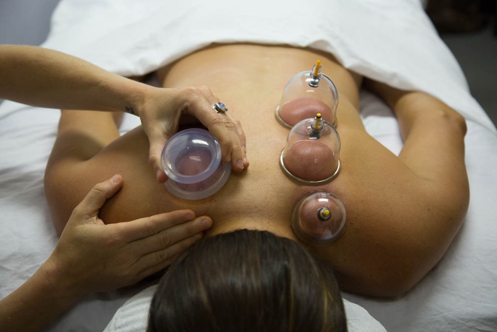 Cupping Courses